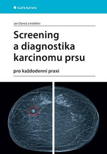 Obálka Screening a diagnostika karcinomu prsu