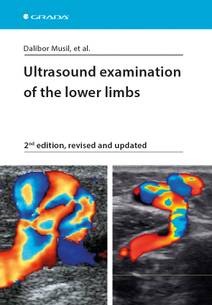 Obálka Ultrasound examination of the lower limbs