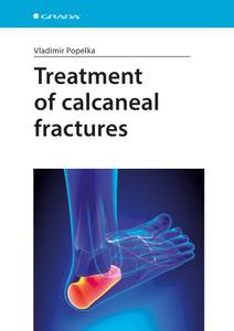 Obálka Treatment of calcaneal fractures