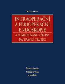 Obálka Intraoperační a perioperační endoskopie a kombinované výkony na trávicí trubici