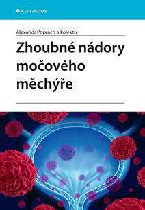 Obálka Zhoubné nádory močového měchýře