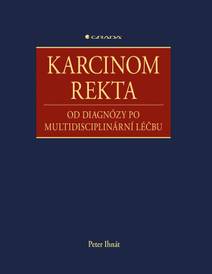Obálka Karcinom rekta