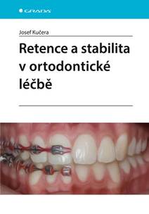 Obálka Retence a stabilita v ortodontické léčbě