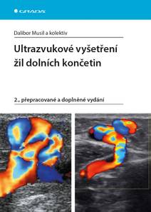 Obálka Ultrazvukové vyšetření žil dolních končetin