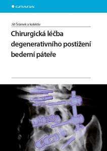 Obálka Chirurgická léčba degenerativního postižení bederní páteře
