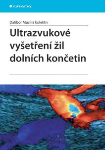 Obálka Ultrazvukové vyšetření žil dolních končetin