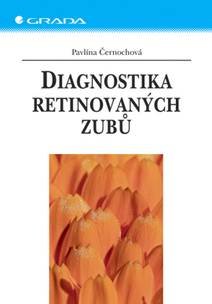 Obálka Diagnostika retinovaných zubů