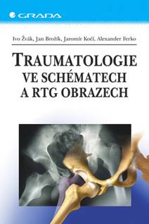 Obálka Traumatologie ve schématech a RTG obrazech
