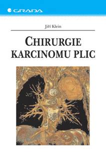 Obálka Chirurgie karcinomu plic