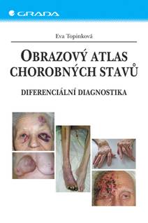 Obálka Obrazový atlas chorobných stavů