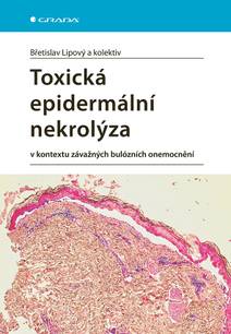 Obálka Toxická epidermální nekrolýza