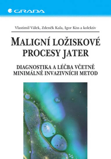 E-kniha Maligní ložiskové procesy jater - Igor Kiss, Vlastimil Válek, Zdeněk Kala