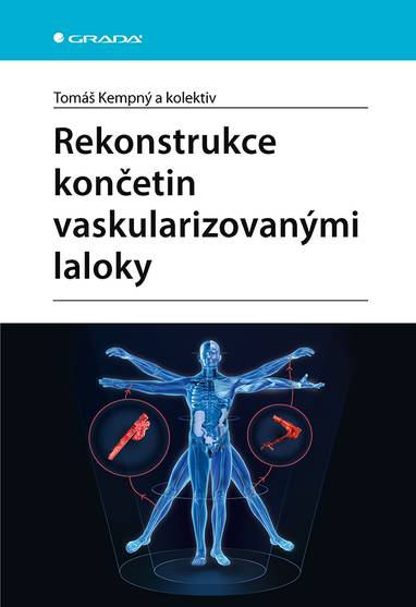 E-kniha Rekonstrukce končetin vaskularizovanými laloky - Tomáš Kempný