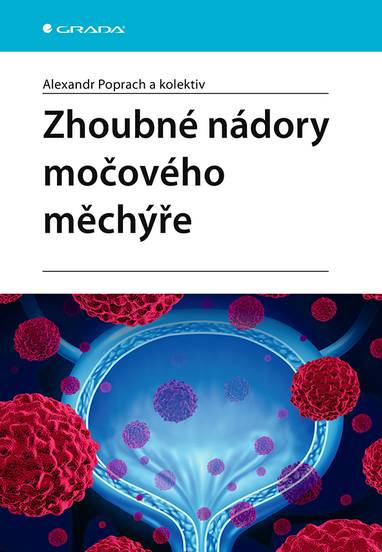 E-kniha Zhoubné nádory močového měchýře - Alexandr Poprach