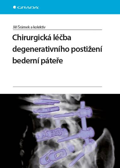 E-kniha Chirurgická léčba degenerativního postižení bederní páteře - Jiří Šrámek