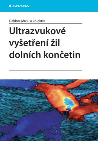 E-kniha Ultrazvukové vyšetření žil dolních končetin - Dalibor Musil