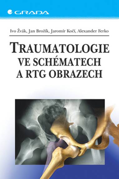 E-kniha Traumatologie ve schématech a RTG obrazech - Jan Brožík, Jaromír Kočí, Ivo Žvák