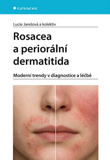 E-kniha Rosacea a periorální dermatitida - Moderní trendy v diagnostice a léčbě - Lucie Jarešová