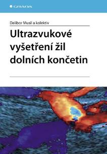 Obálka Ultrazvukové vyšetření žil dolních končetin