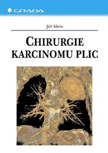 Obálka Chirurgie karcinomu plic