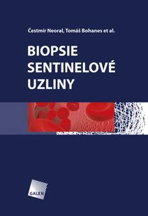 Obálka Biopsie sentinelové uzliny