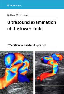 Obálka Ultrasound examination of the lower limbs