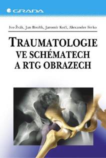 Obálka Traumatologie ve schématech a RTG obrazech
