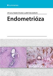 Obálka Endometrióza