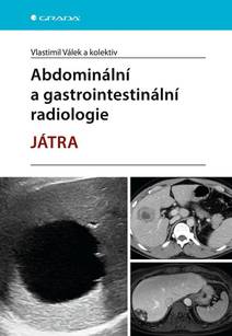 Obálka Abdominální a gastrointestinální radiologie