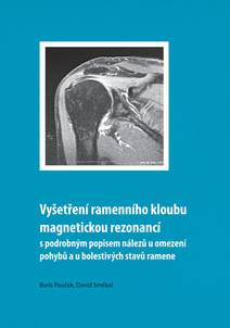 Obálka Vyšetření ramenního kloubu magnetickou rezonancí s podrobným popisem nálezů u omezení pohybů u bolestivých stavů ramene