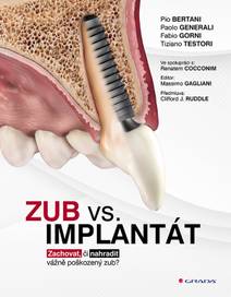 Obálka Zub vs. implantát