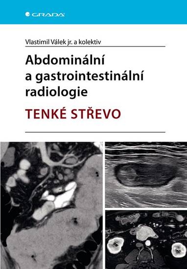E-kniha Abdominální a gastrointestinální radiologie - kolektiv a, jr. Vlastimil Válek